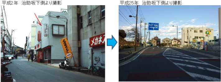 都市計画道路3・4・37号新旧対比、左は平成2年の治助坂下側からの写真で道路が狭く、右は平成25年の広くなった道路の写真。